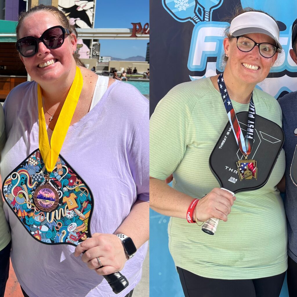 A happy pickleball player with winner's medals after previously weighing nearly 400 lbs.